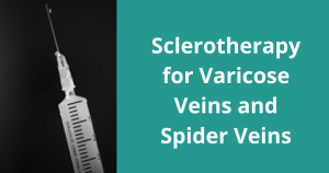 Sclerotherapy-for-Varicose-Veins-and-Spider-Veins-300x158