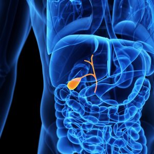 Complications of Gallstones: What Are They?