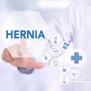 Hernia Surgery: All Major FAQs Answered!