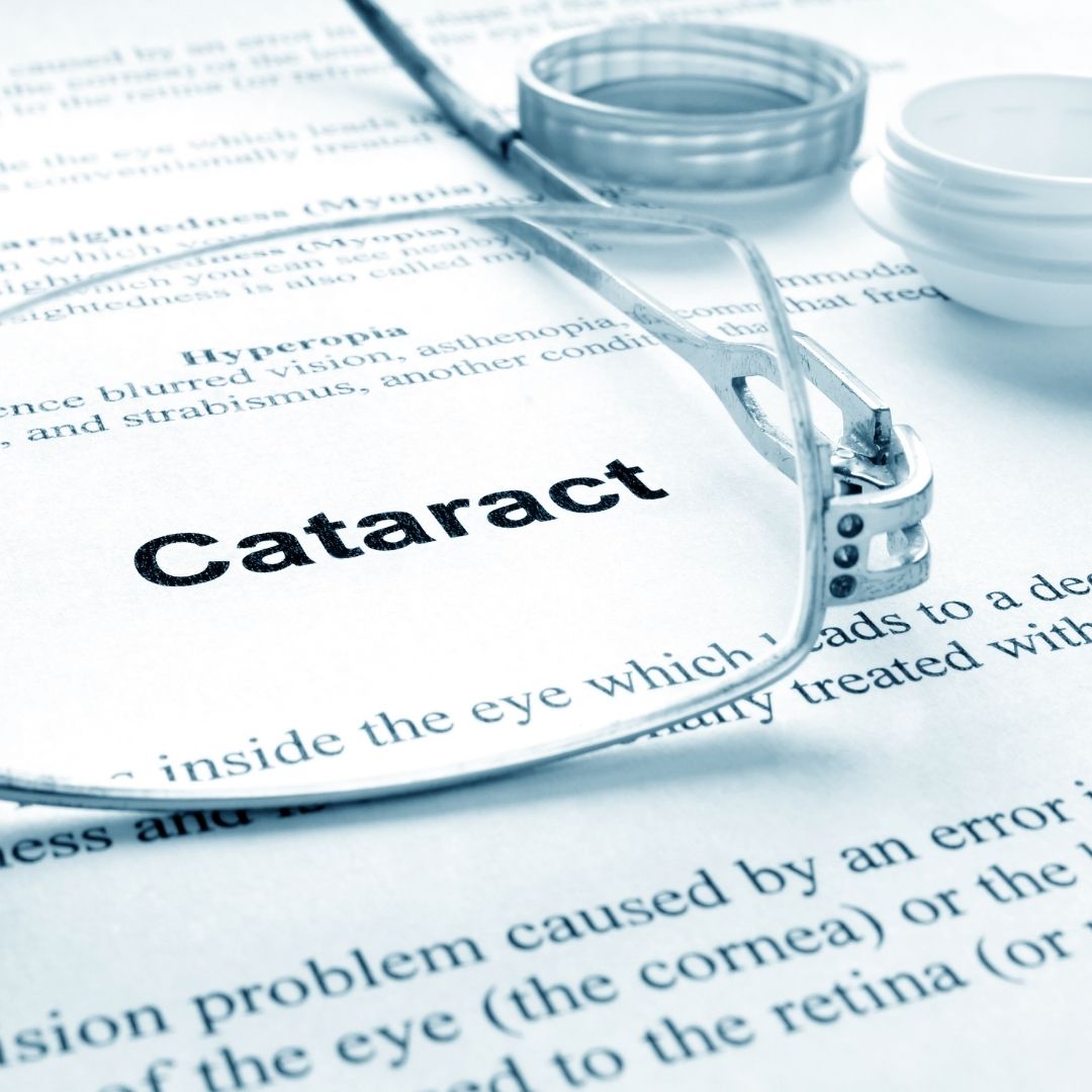5 Reasons Why You Should Go for a Laser Cataract Surgery