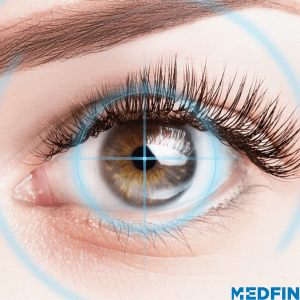 Femtosecond Laser Cataract Surgery – Advanced Cure in just 45 Mins!