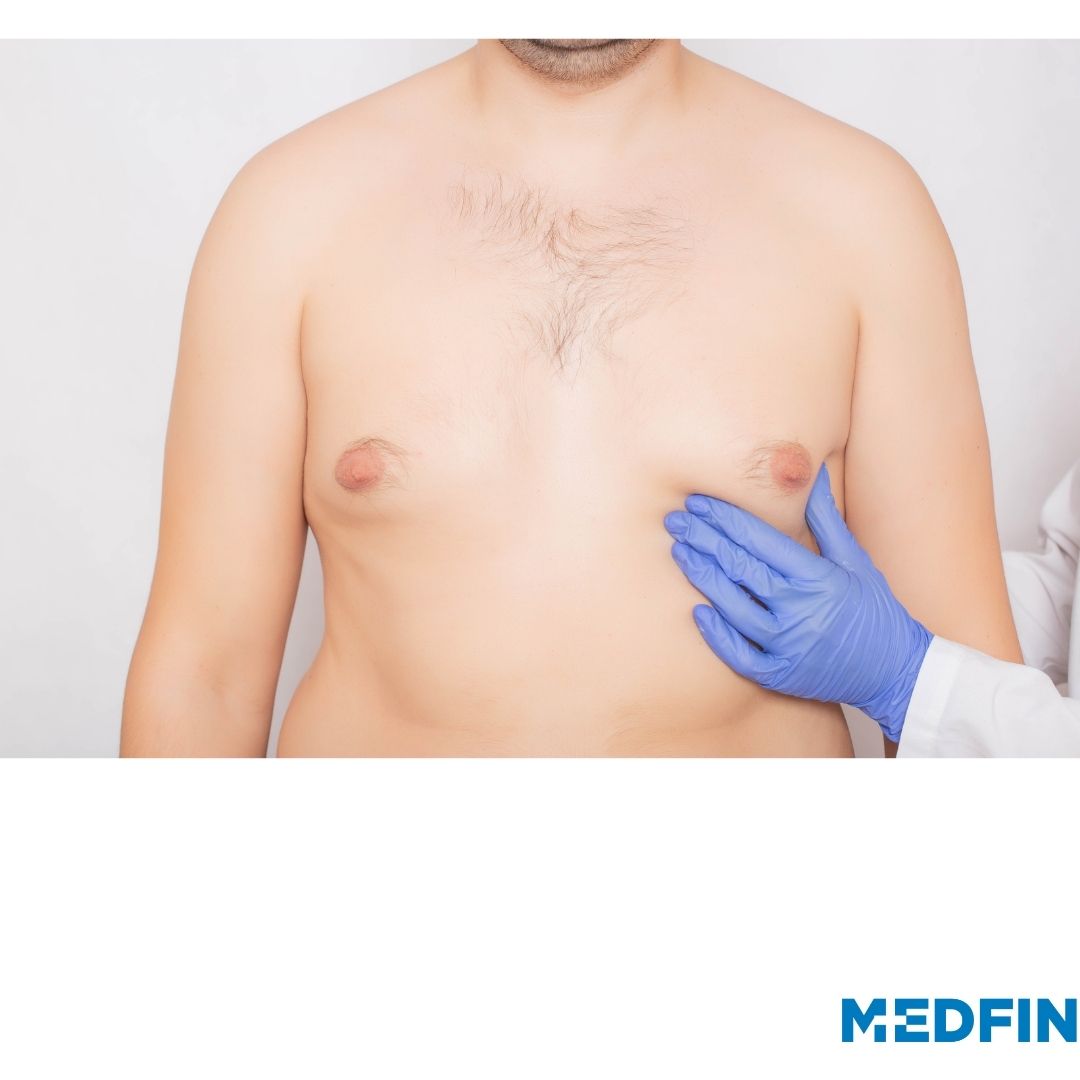 Gynecomastia Symptoms: Recognizing Signs of Male Breast Enlargement