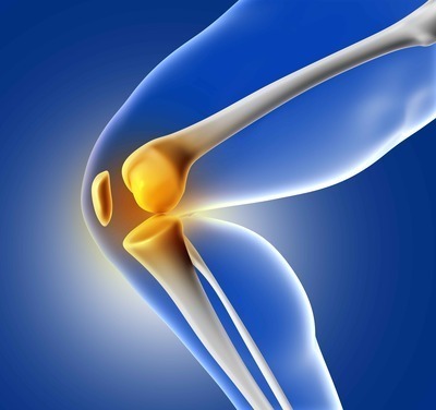 What Does A Total Knee Replacement Look Like?