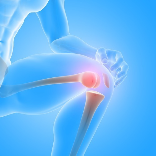How Long Does a Total Knee Replacement Last