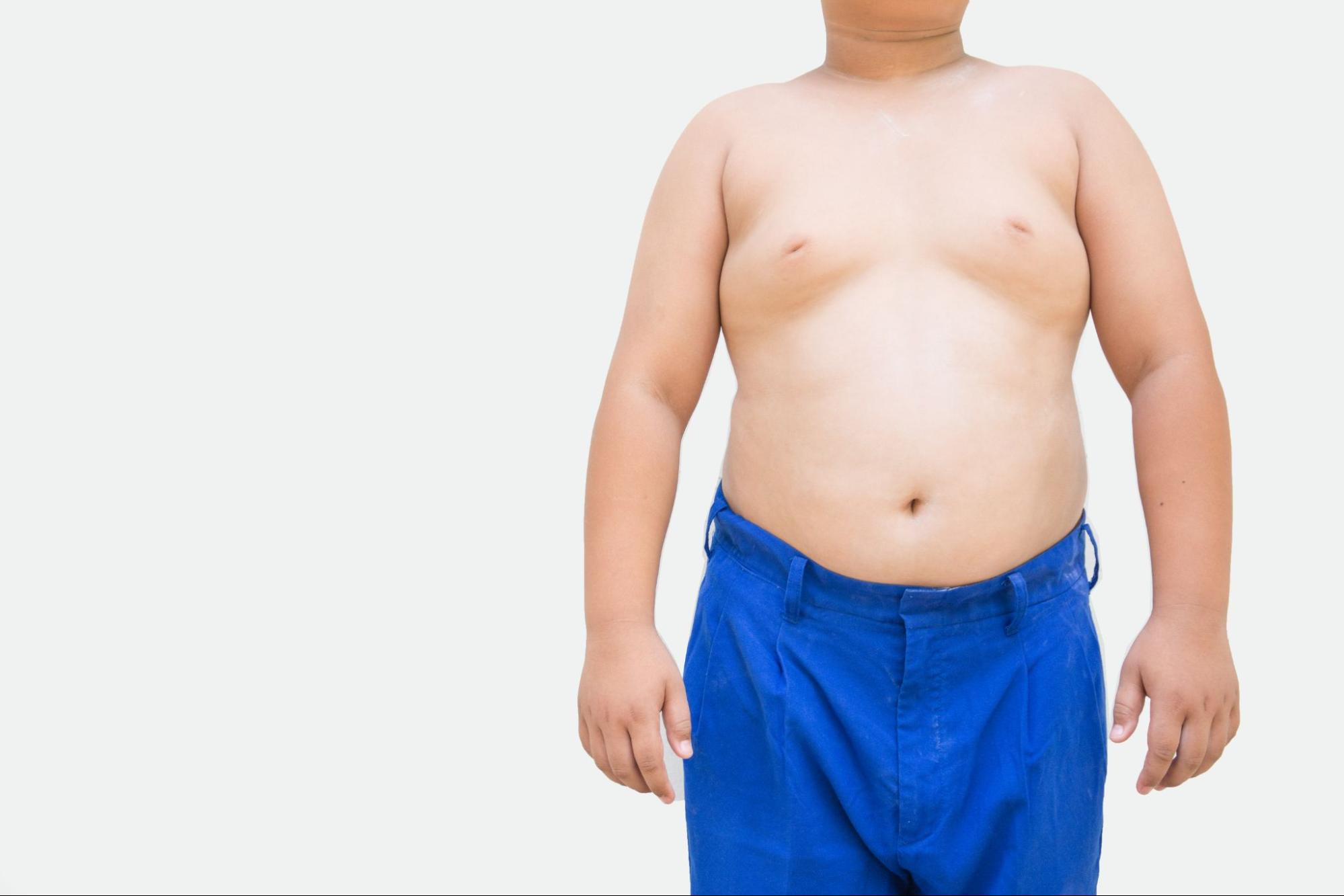 What is the Best Treatment for Gynecomastia?