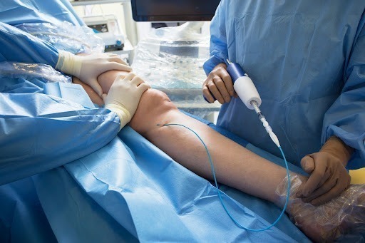 Minimally Invasive Techniques for Varicose Vein Surgery: Benefits and Considerations