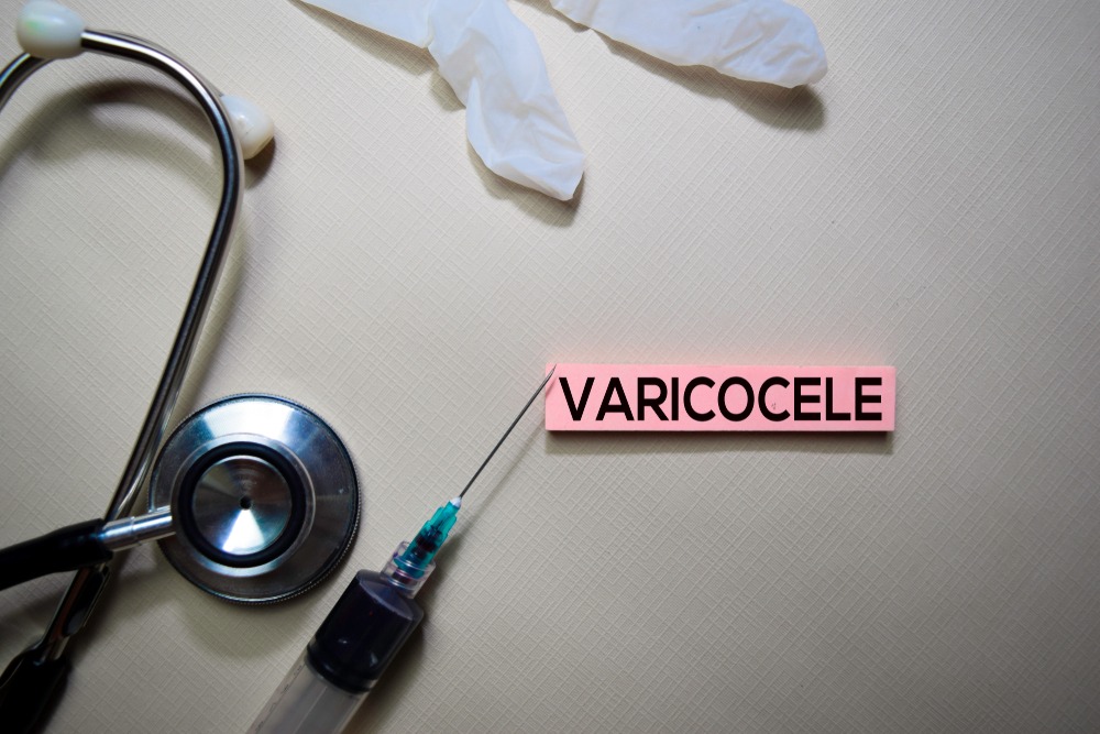 Varicocele Embolization Repair for Infertility: A Comprehensive Look