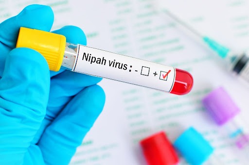Decoding Nipah Virus: Diagnosis &Treatment Strategies