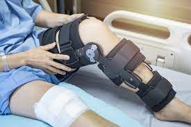 How Long do You Wear a Brace After ACL Surgery?