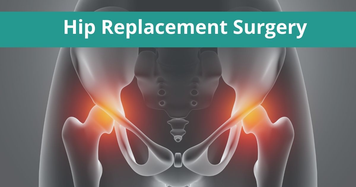 Benefits and Risks of Hip Replacement