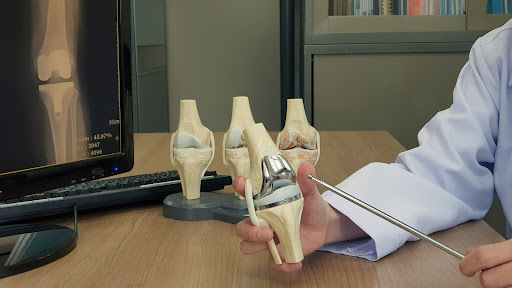 Precision Healing: Exploring Robotic Total Knee Replacement Surgery